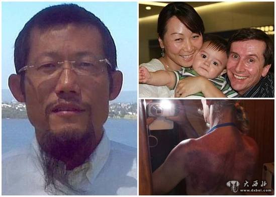 中國"神醫"治死澳洲7歲兒童:治糖尿病靠拍打拉筋