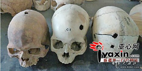 新疆考古發(fā)現60余個(gè)穿孔頭骨 巫醫治病、頭骨崇拜？學(xué)術(shù)界觀(guān)點(diǎn)不一