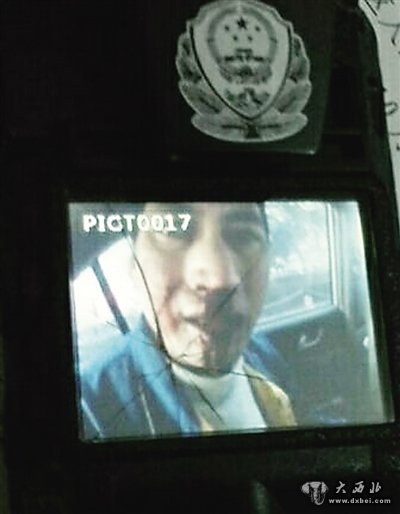 男子拒付車(chē)費還動(dòng)手 的哥鼻骨被打骨折